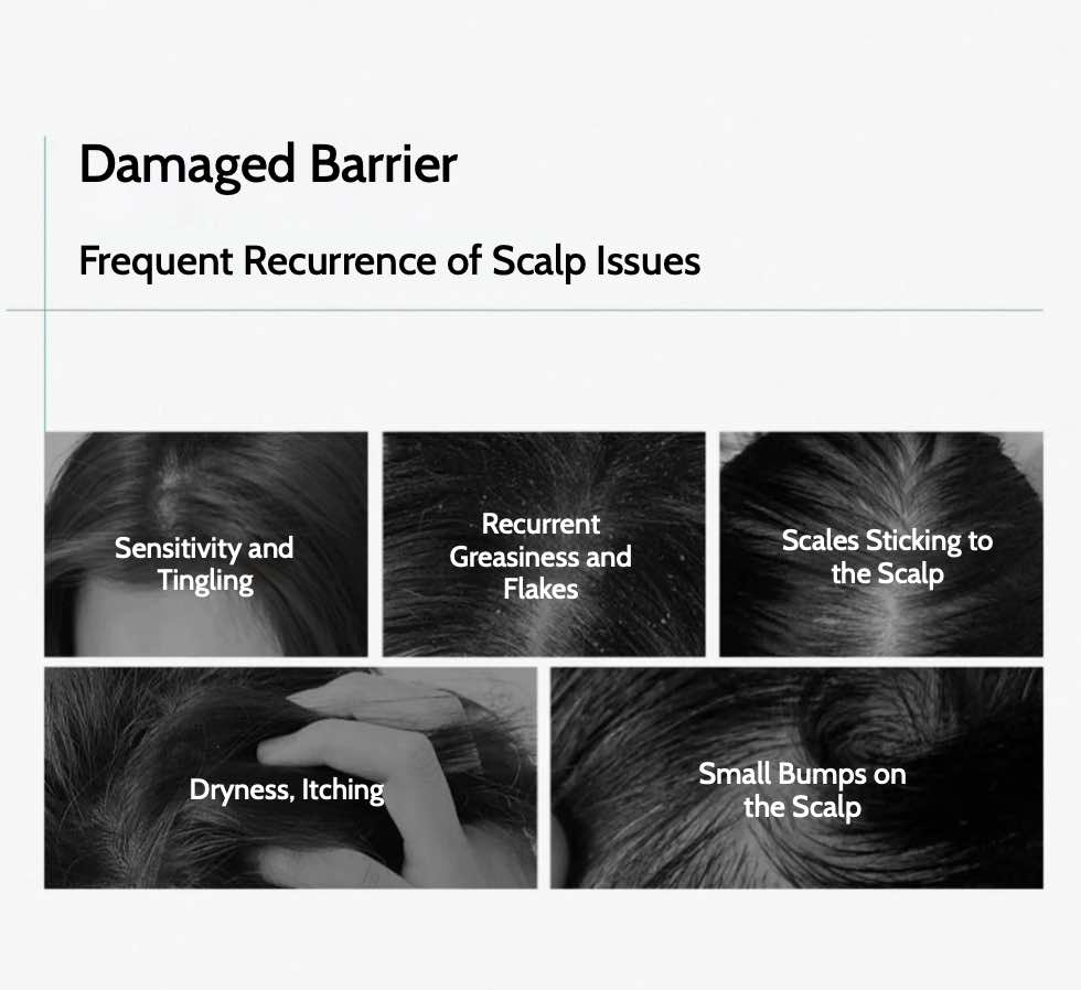 Clinitech scalp essence Dandruff removing shampoo can quickly and effectively solve dandruff problems without harming your hair and skin, especially for people with sensitive scalp.