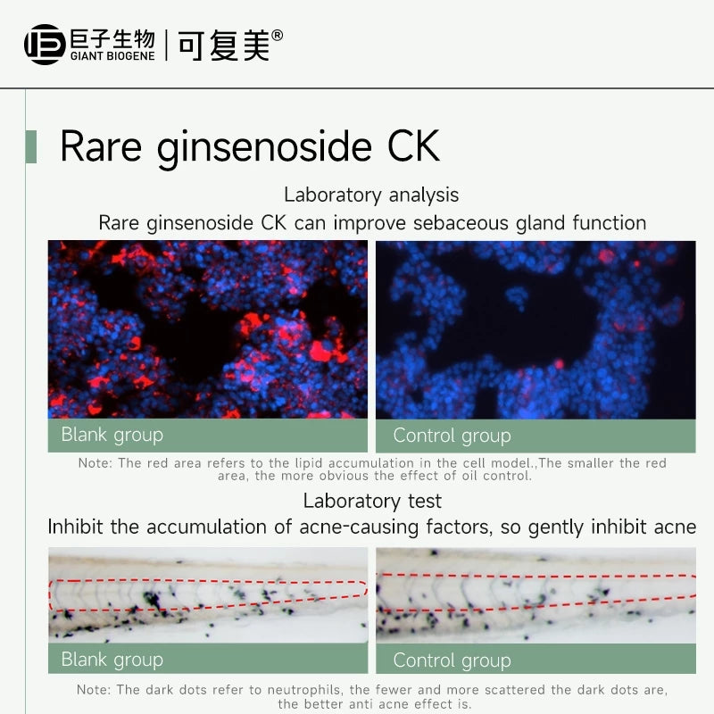 KOMFYMED Rare Ginsenoside Anti-Acne Soothing Single Use Essence