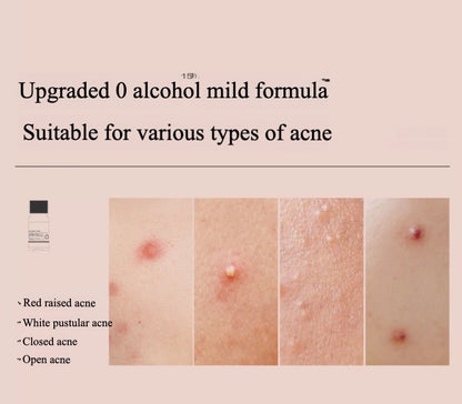 BIGDROP Precision Acne Spot Serum