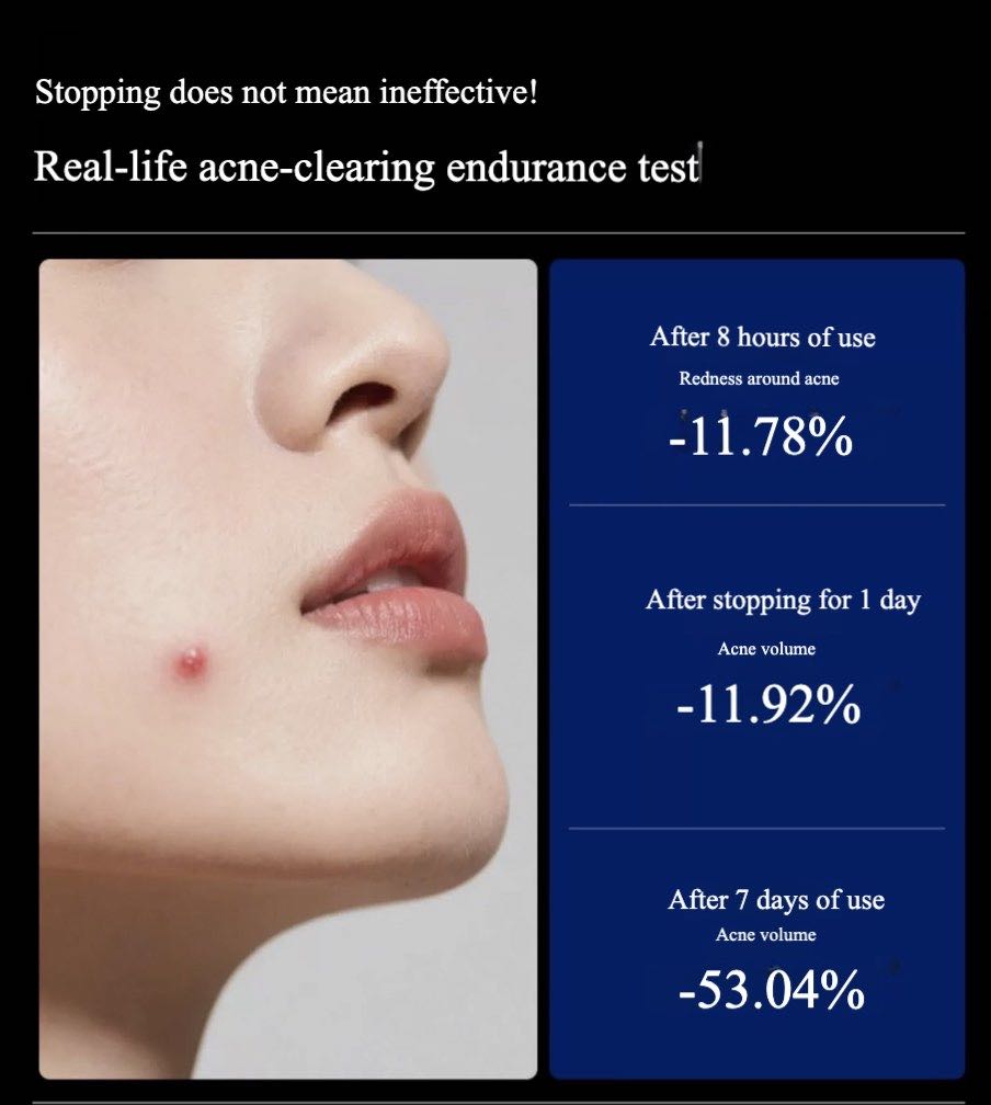 BIGDROP Precision Acne Spot Serum
