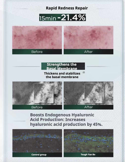 Biohyalux HA Barrier Conditioning Single Use Essence