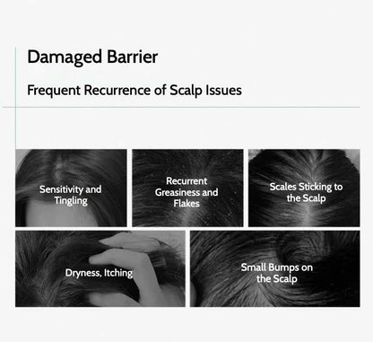 Clinitech scalp essence Dandruff removing shampoo can quickly and effectively solve dandruff problems without harming your hair and skin, especially for people with sensitive scalp. 