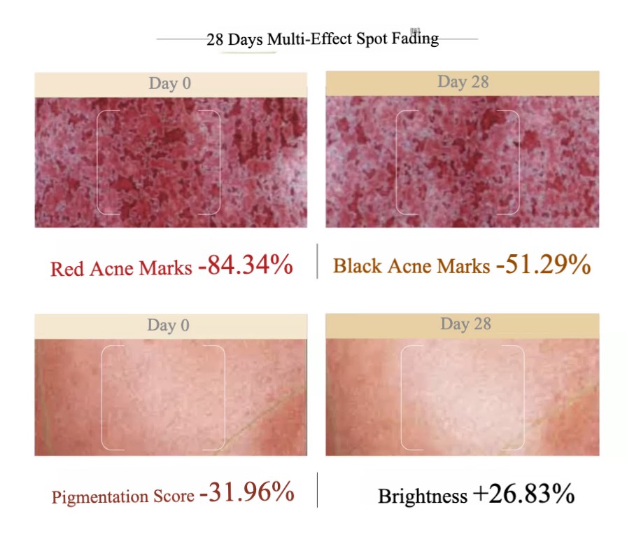GUYU Whitening Luminosity Spot Correcting Essence