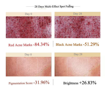 GUYU Whitening Luminosity Spot Correcting Essence