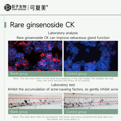 KOMFYMED Rare Ginsenoside Anti-Acne And Oil Control Essence
