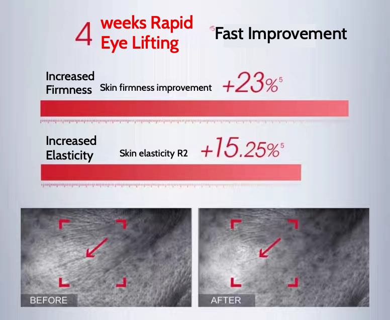 PROYA Anti-Aging and Firming Eye Cream effectively reduces fine lines, wrinkles, and signs of aging around the eyes. Powered by retinol and hexapeptide-1, it restores youthful radiance to your skin.