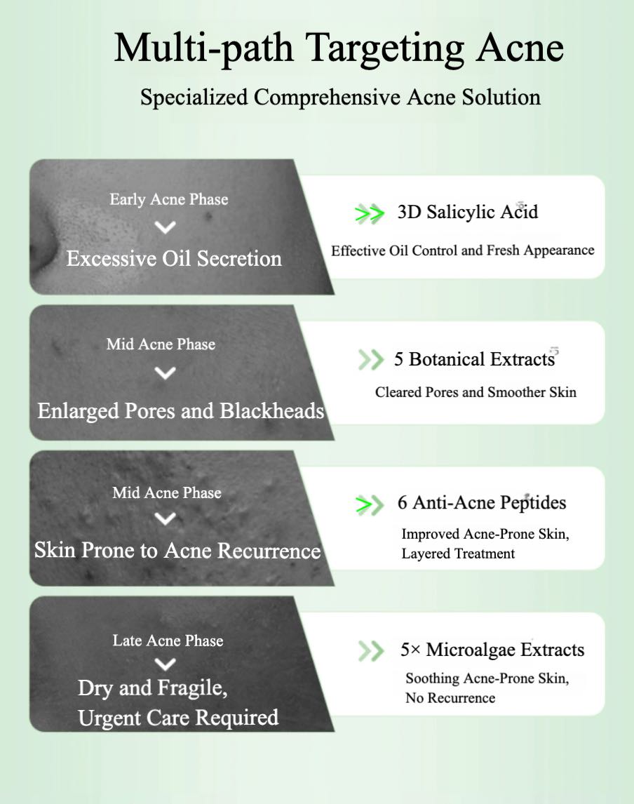 QUADHA 5D Mixed-acid Single Use Anti-acne Essence
