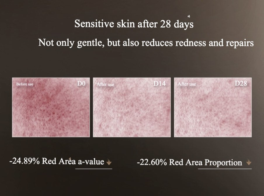 UNISKIN RICH FOAM SOOTHING CLEANSER