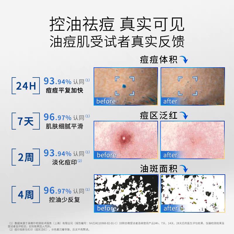 Voolga Acne Cleansing Essence