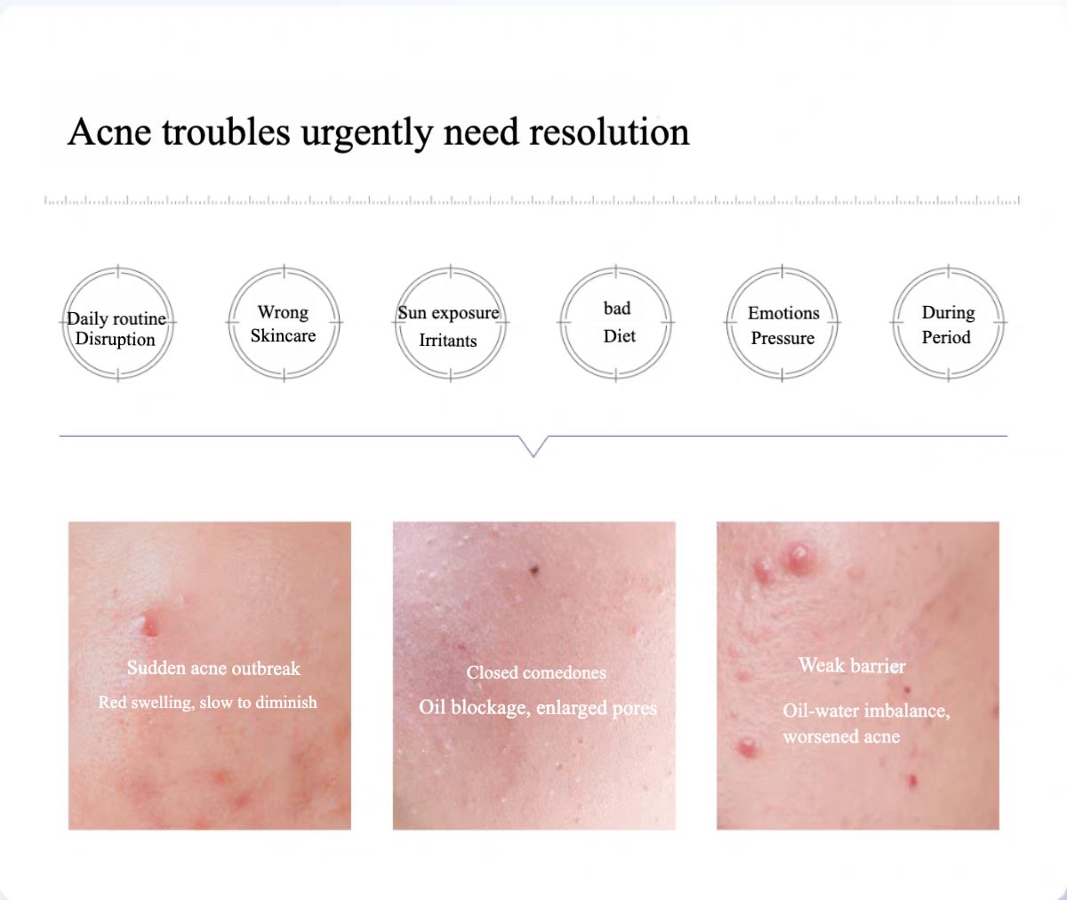 Voolga Acne Cleansing Repair Mask