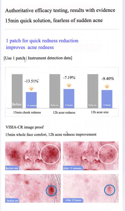 Voolga Acne Cleansing Repair Mask