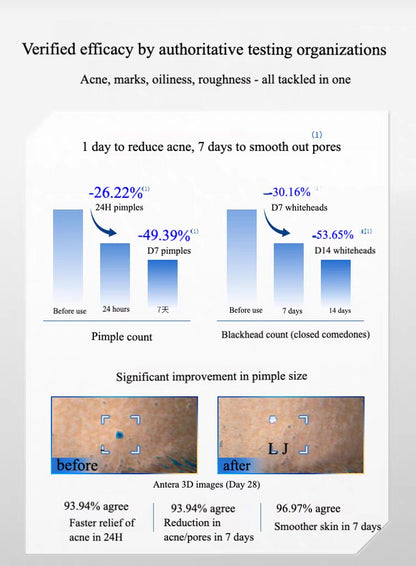 Voolga Acne Cleansing Repair Essence