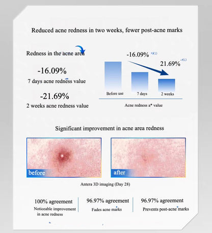 Voolga Acne Cleansing Repair Essence
